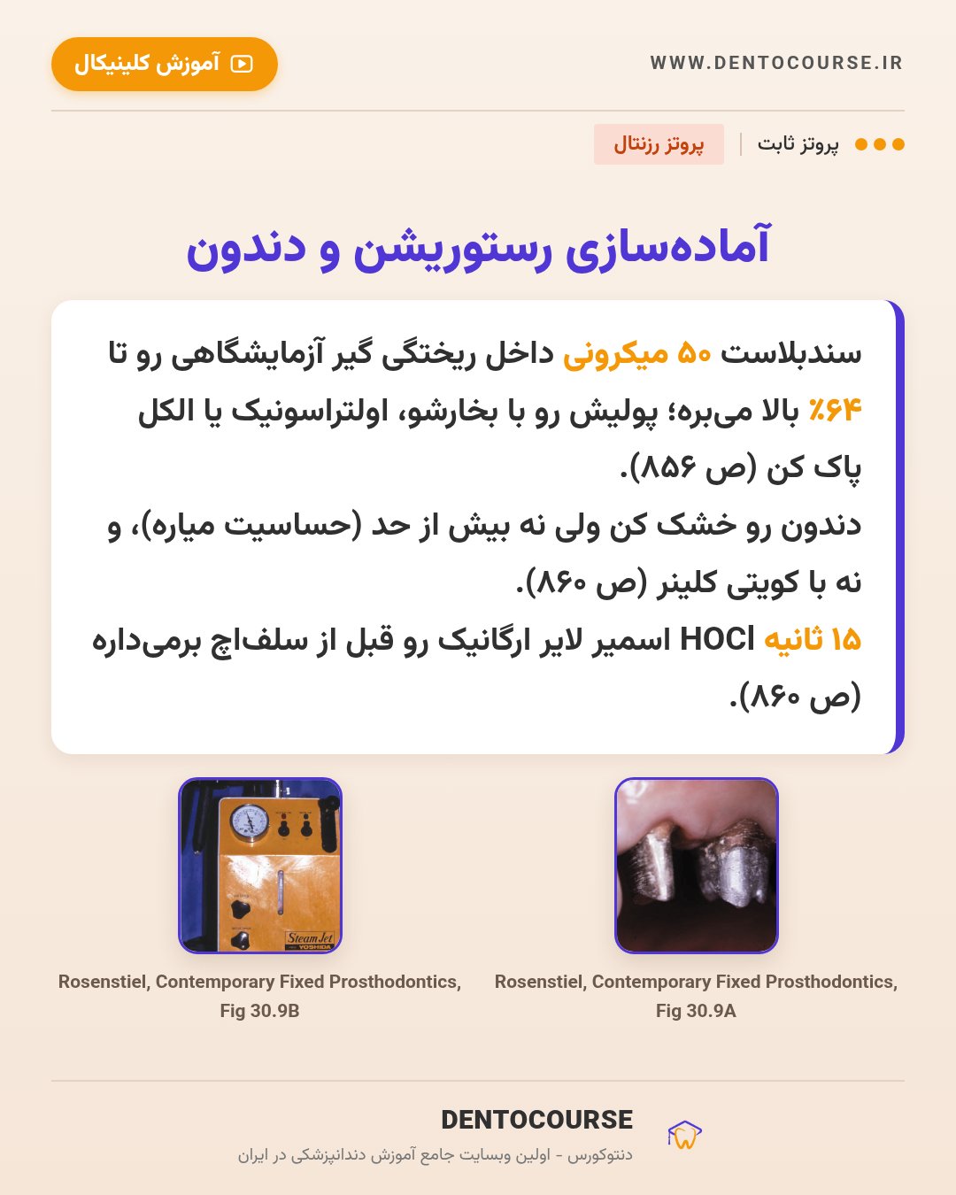 انتخاب سمان در پروتز ثابت؛ راهنمای کامل از پروتز رزنتال (فصل ۳۰) 7 آمادهسازی رستوریشن و دندان قبل از سمان رزینی