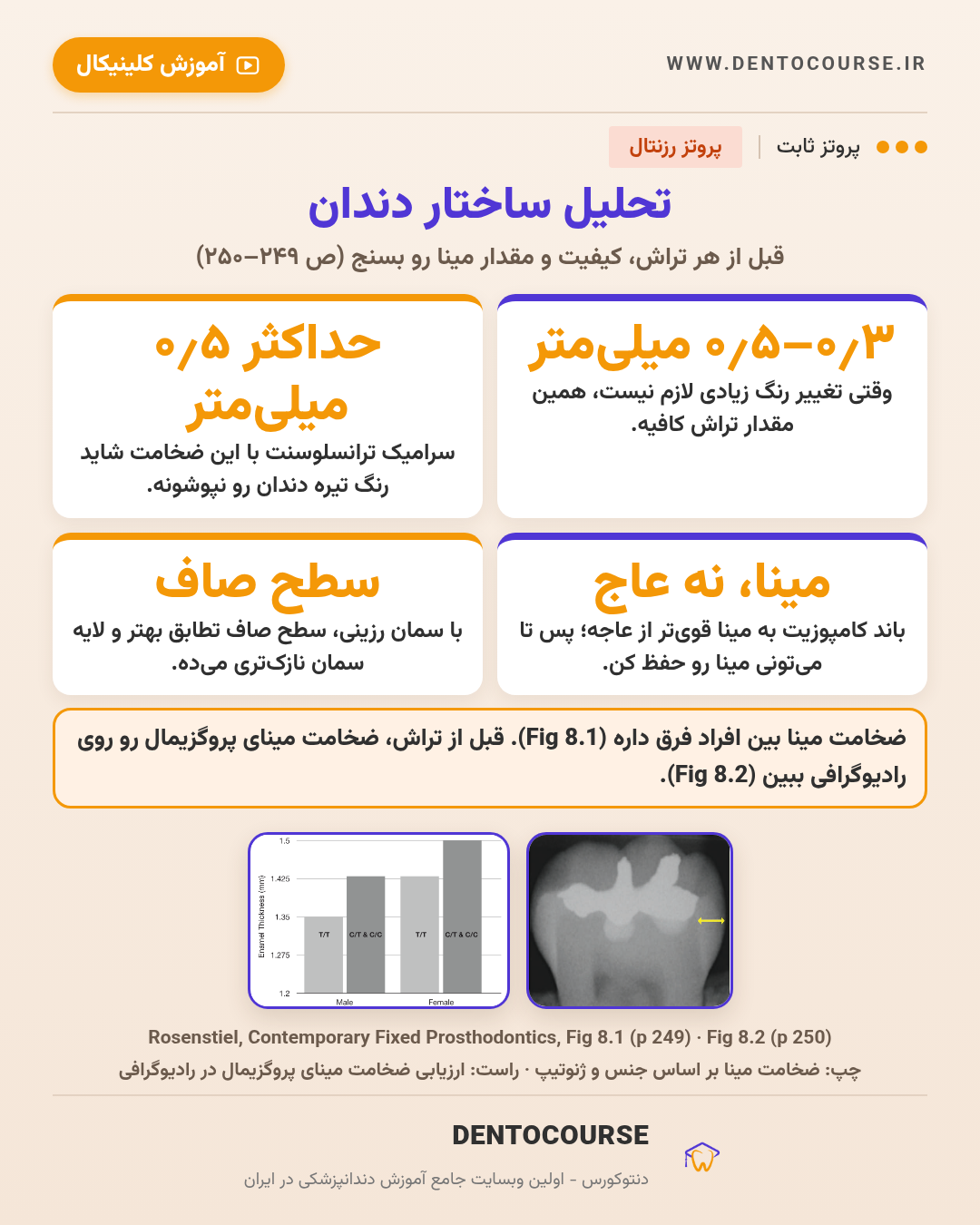 تراش برای رستوریشنهای سرامیکی؛ راهنمای عددی فصل ۸ پروتز رزنتال 3 تحلیل ضخامت مینا قبل از تراش برای رستوریشن سرامیکی؛ Fig 8.1 و 8.2 پروتز رزنتال