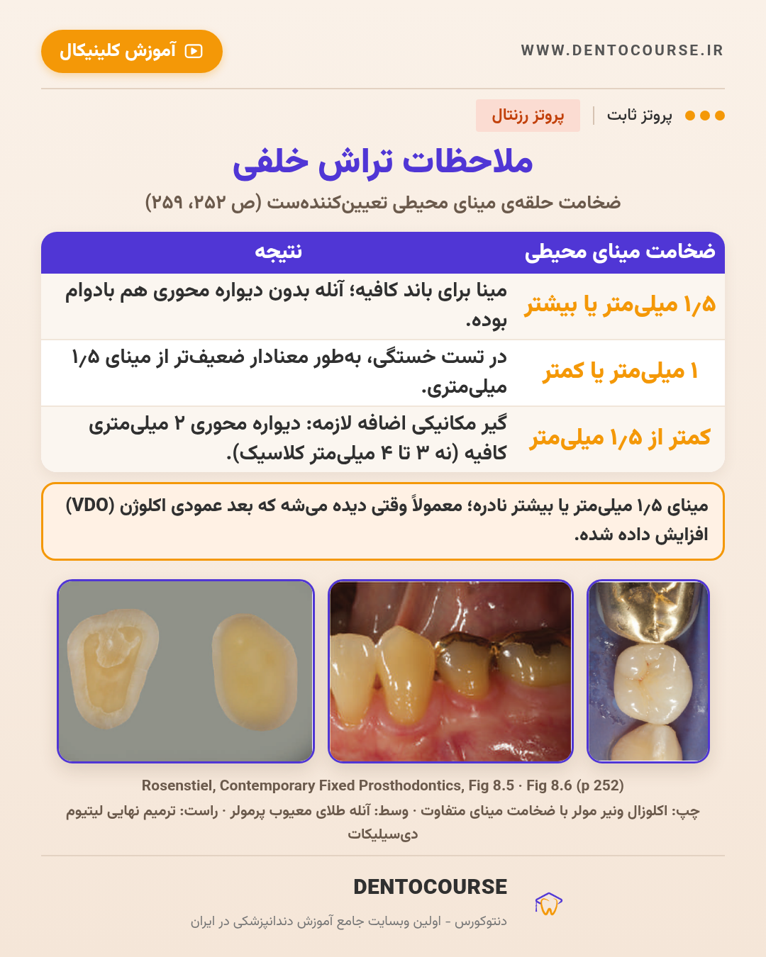 تراش برای رستوریشنهای سرامیکی؛ راهنمای عددی فصل ۸ پروتز رزنتال 5 ملاحظات تراش خلفی و ضخامت مینای محیطی برای آنله سرامیکی؛ Fig 8.5 و 8.6 پروتز رزنتال