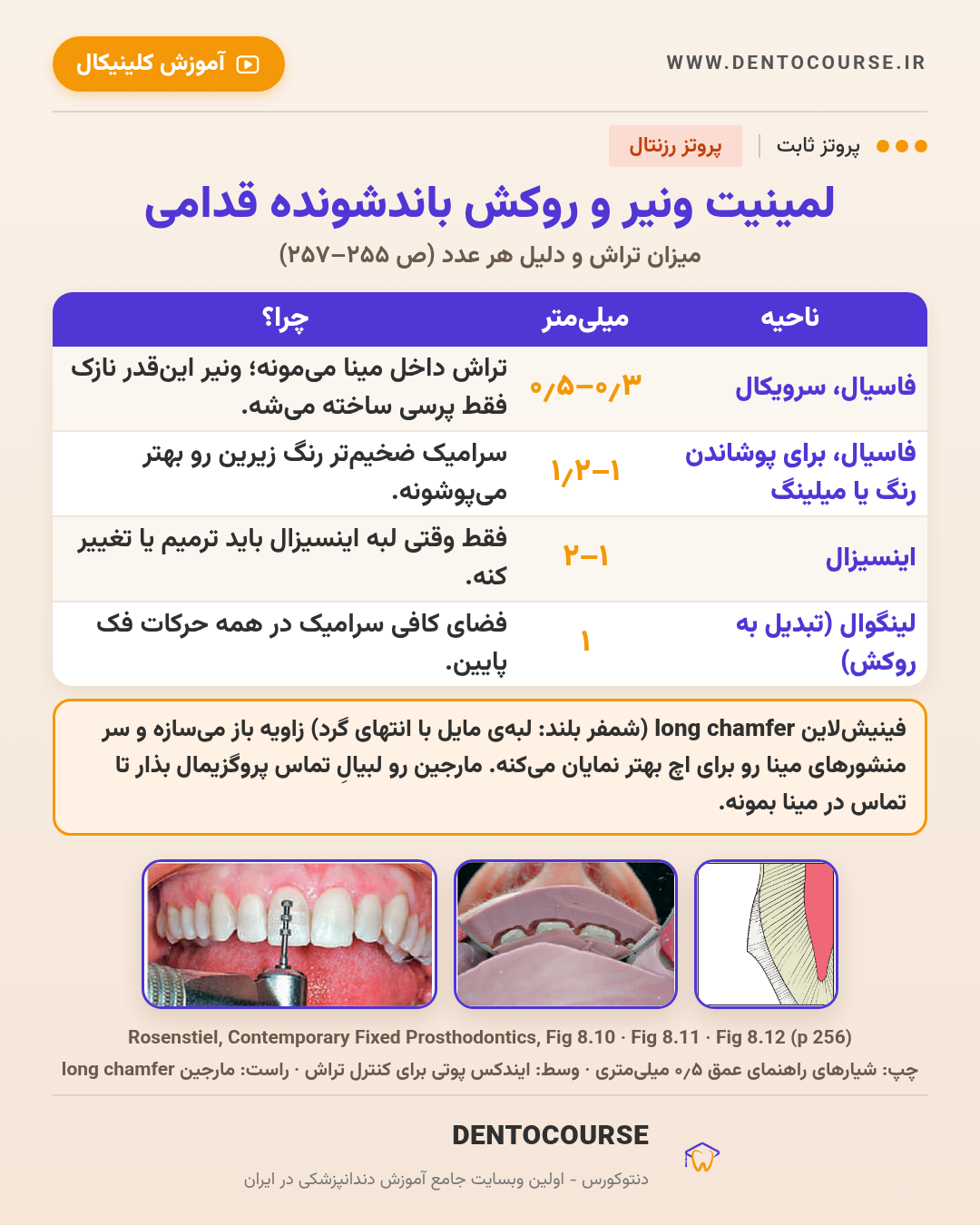 تراش برای رستوریشنهای سرامیکی؛ راهنمای عددی فصل ۸ پروتز رزنتال 10 میزان تراش لمینیت ونیر و روکش باندشونده قدامی؛ Fig 8.10 تا 8.12 پروتز رزنتال