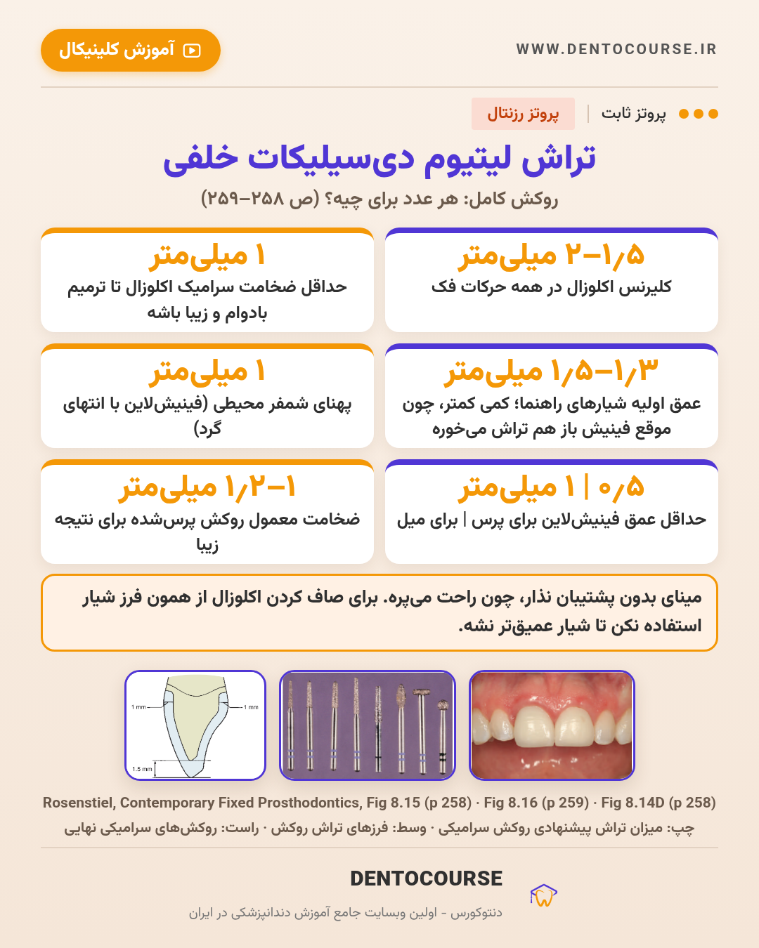 تراش برای رستوریشنهای سرامیکی؛ راهنمای عددی فصل ۸ پروتز رزنتال 11 میزان تراش روکش لیتیوم دیسیلیکات خلفی؛ Fig 8.15 و 8.16 پروتز رزنتال