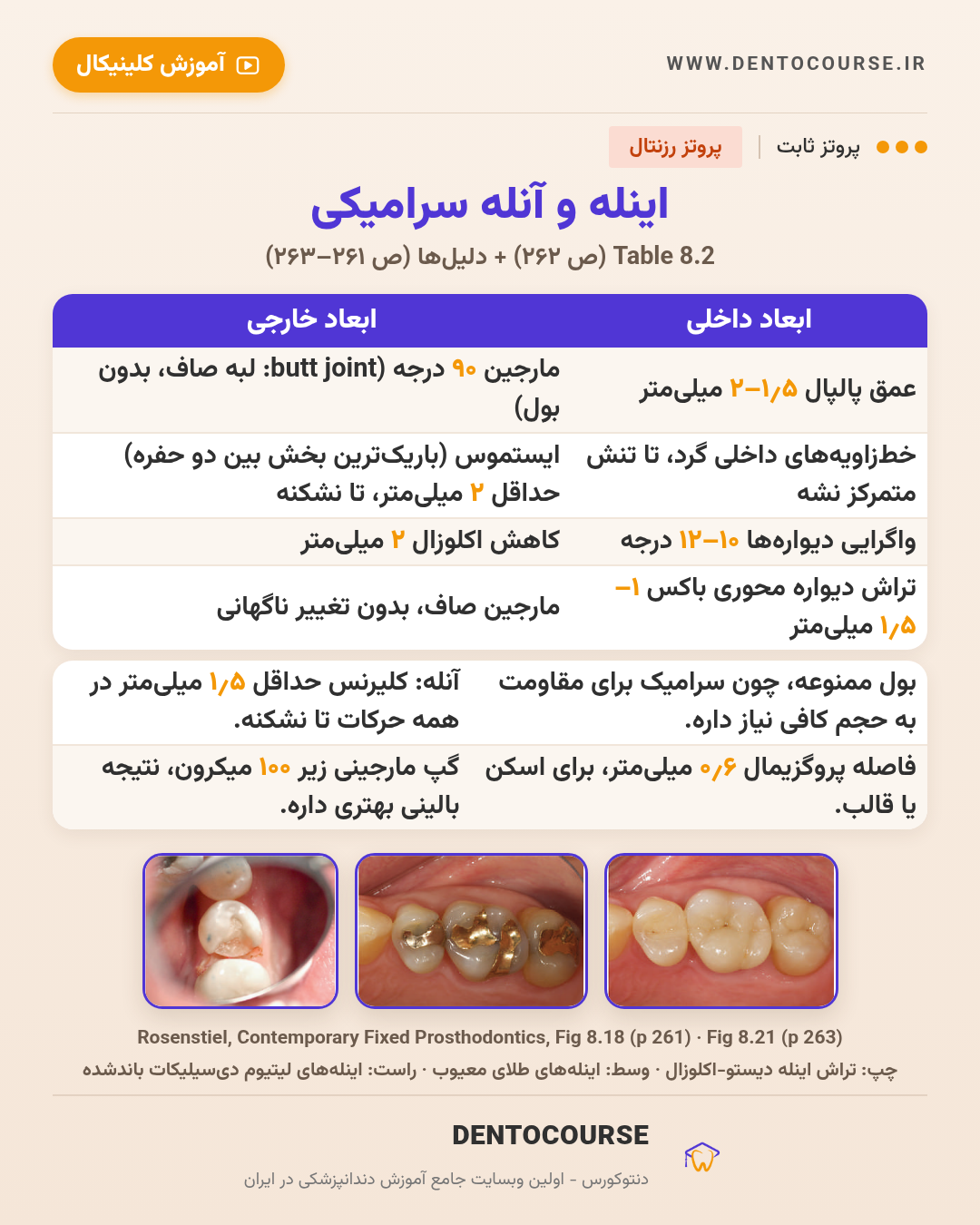 تراش برای رستوریشنهای سرامیکی؛ راهنمای عددی فصل ۸ پروتز رزنتال 12 راهنمای تراش اینله و آنله سرامیکی؛ جدول ۸.۲ و Fig 8.18 و 8.21 پروتز رزنتال